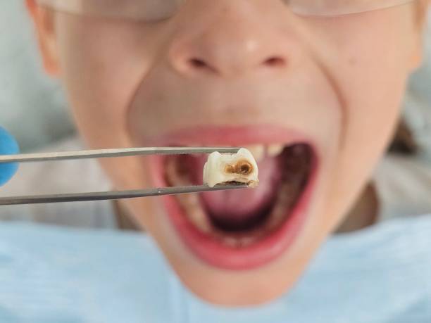 Best Pediatric Emergency Dentist in Richmond, KY
